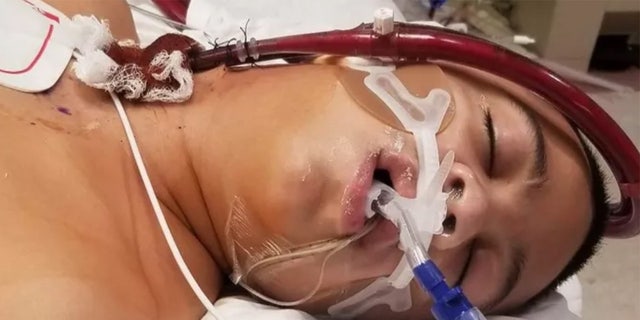 Zachary Corona, 13, shown in the hospital after a group of bullies allegedly pressured him to smoke a fentanyl-laced vape.